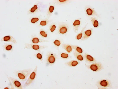 Immunocytochemistry - Anti-Histone H3 (butyryl K18) antibody (AB241458)