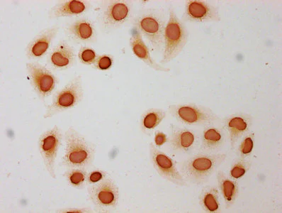 Immunocytochemistry - Anti-Histone H3 (butyryl K9) antibody (AB241248)