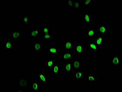 Immunocytochemistry/ Immunofluorescence - Anti-Histone H3 (butyryl K9) antibody (AB241248)