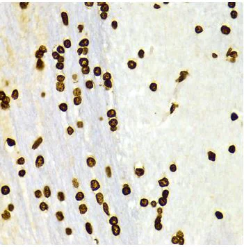 Immunohistochemistry (Formalin/PFA-fixed paraffin-embedded sections) - Anti-Histone H3 (di methyl K27) antibody - ChIP Grade (AB194690)