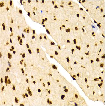Immunohistochemistry (Formalin/PFA-fixed paraffin-embedded sections) - Anti-Histone H3 (di methyl K27) antibody - ChIP Grade (AB194690)