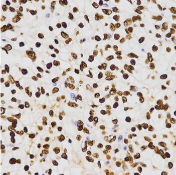Immunohistochemistry (Formalin/PFA-fixed paraffin-embedded sections) - Anti-Histone H3 (di methyl K27) antibody - ChIP Grade (AB194690)