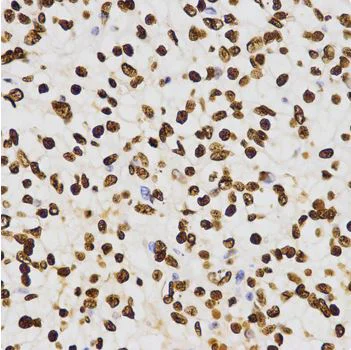 Immunohistochemistry (Formalin/PFA-fixed paraffin-embedded sections) - Anti-Histone H3 (di methyl K27) antibody - ChIP Grade (AB194690)
