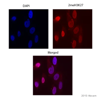 Immunocytochemistry/ Immunofluorescence - Anti-Histone H3 (di methyl K27) antibody - ChIP Grade (AB24684)