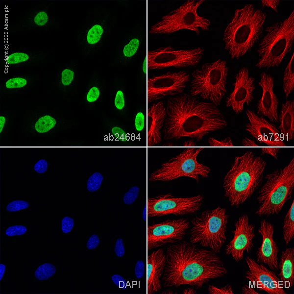 Immunocytochemistry/ Immunofluorescence - Anti-Histone H3 (di methyl K27) antibody - ChIP Grade (AB24684)