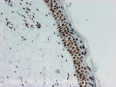 Immunohistochemistry (Formalin/PFA-fixed paraffin-embedded sections) - Anti-Histone H3 (di methyl K27) antibody - ChIP Grade (AB24684)
