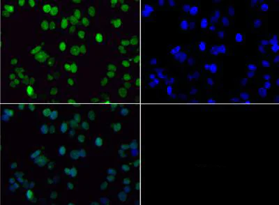 Immunocytochemistry/ Immunofluorescence - Anti-Histone H3 (di methyl K36) antibody (AB272158)