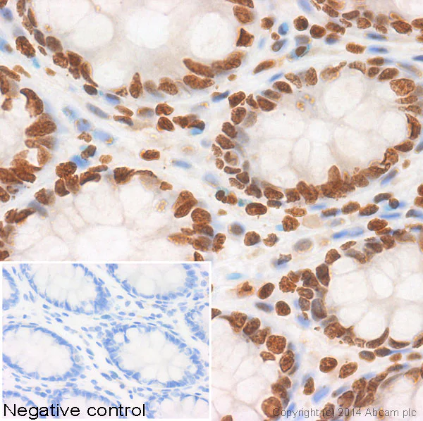 Immunohistochemistry (Formalin/PFA-fixed paraffin-embedded sections) - Anti-Histone H3 (di methyl K36) antibody - ChIP Grade (AB9049)