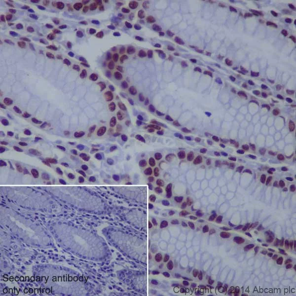 Immunohistochemistry (Formalin/PFA-fixed paraffin-embedded sections) - Anti-Histone H3 (di methyl K36) antibody [EPR16994(2)] - BSA and Azide free (AB239408)