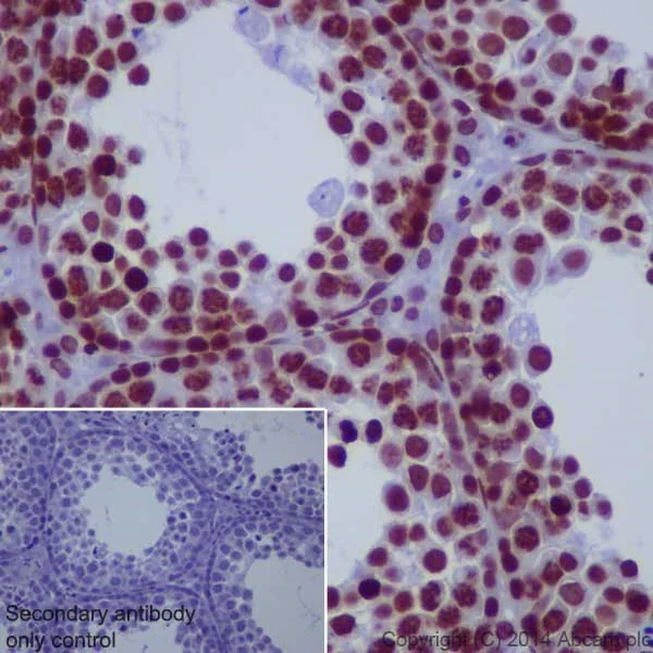 Immunohistochemistry (Formalin/PFA-fixed paraffin-embedded sections) - Anti-Histone H3 (di methyl K36) antibody [EPR16994(2)] - BSA and Azide free (AB239408)