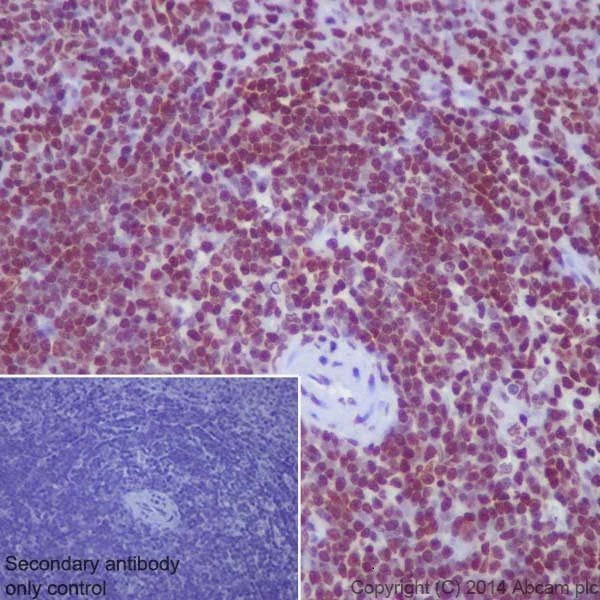 Immunohistochemistry (Formalin/PFA-fixed paraffin-embedded sections) - Anti-Histone H3 (di methyl K36) antibody [EPR16994(2)] - BSA and Azide free (AB239408)