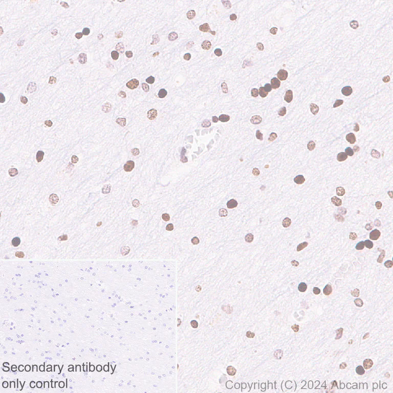 Immunohistochemistry (Formalin/PFA-fixed paraffin-embedded sections) - Anti-Histone H3 (di methyl K36) antibody [EPR28335-73] (AB318964)