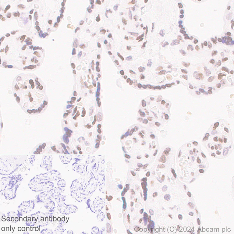 Immunohistochemistry (Formalin/PFA-fixed paraffin-embedded sections) - Anti-Histone H3 (di methyl K36) antibody [EPR28335-73] (AB318964)