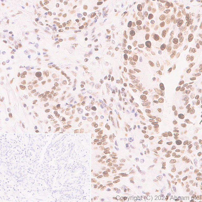 Immunohistochemistry (Formalin/PFA-fixed paraffin-embedded sections) - Anti-Histone H3 (di methyl K36) antibody [EPR28335-73] (AB318964)