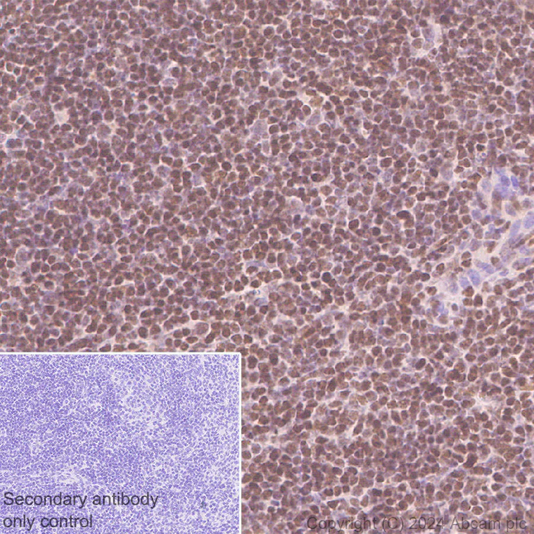 Immunohistochemistry (Formalin/PFA-fixed paraffin-embedded sections) - Anti-Histone H3 (di methyl K36) antibody [EPR28335-73] (AB318964)
