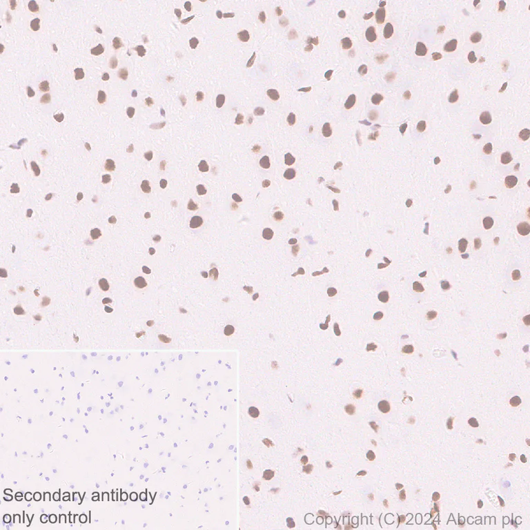 Immunohistochemistry (Formalin/PFA-fixed paraffin-embedded sections) - Anti-Histone H3 (di methyl K36) antibody [EPR28335-73] (AB318964)