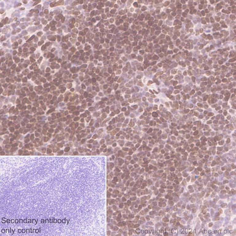 Immunohistochemistry (Formalin/PFA-fixed paraffin-embedded sections) - Anti-Histone H3 (di methyl K36) antibody [EPR28335-73] (AB318964)