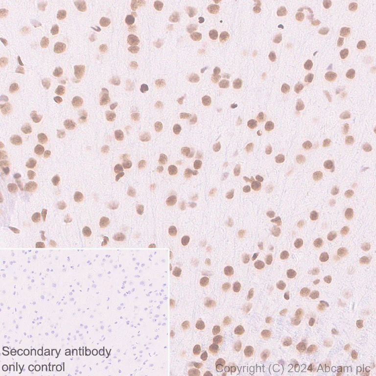 Immunohistochemistry (Formalin/PFA-fixed paraffin-embedded sections) - Anti-Histone H3 (di methyl K36) antibody [EPR28335-73] - BSA and Azide free (AB318965)