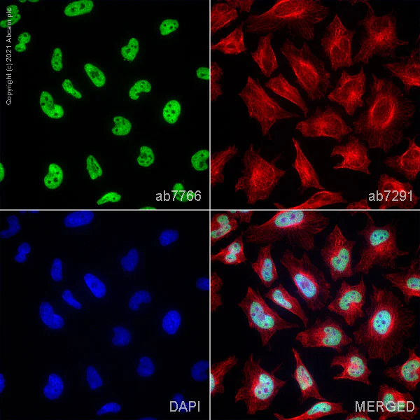Immunocytochemistry/ Immunofluorescence - Anti-Histone H3 (di methyl K4) antibody - ChIP Grade (AB7766)