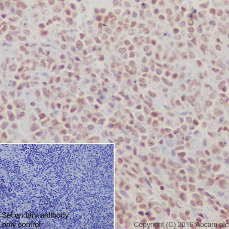 Immunohistochemistry (Formalin/PFA-fixed paraffin-embedded sections) - Anti-Histone H3 (di methyl K4) antibody [Y47] - BSA and Azide free (AB173324)
