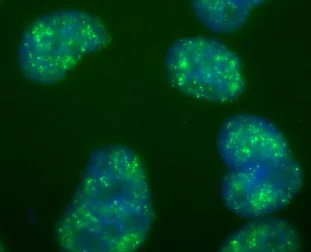 Immunocytochemistry/ Immunofluorescence - Anti-Histone H3 (di methyl K4, tri methyl K4) antibody [mAbcam 6000] - ChIP Grade (AB6000)