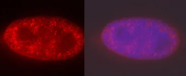 Immunocytochemistry/ Immunofluorescence - Anti-Histone H3 (di methyl K4, tri methyl K4) antibody [mAbcam 6000] - ChIP Grade (AB6000)