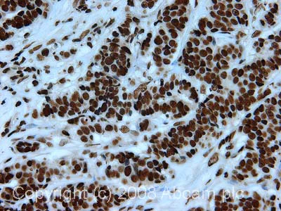 Immunohistochemistry (Formalin/PFA-fixed paraffin-embedded sections) - Anti-Histone H3 (di methyl K79) antibody - ChIP Grade (AB3594)
