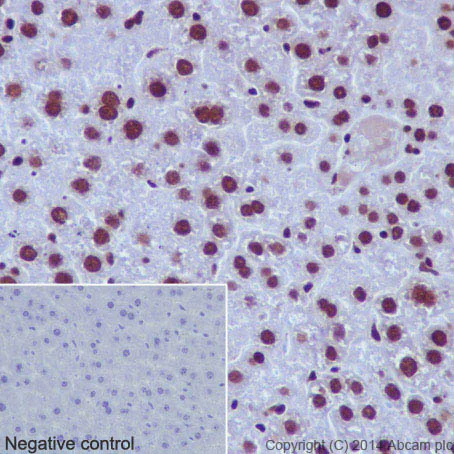 Immunohistochemistry (Formalin/PFA-fixed paraffin-embedded sections) - Anti-Histone H3 (di methyl K79) antibody [EPR17467] - BSA and Azide free (AB249947)