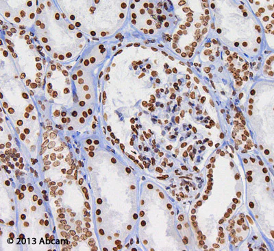 Immunohistochemistry (Formalin/PFA-fixed paraffin-embedded sections) - Anti-Histone H3 (di methyl K9) antibody [mAbcam 1220] - ChIP Grade (AB1220)