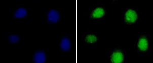 Immunocytochemistry/ Immunofluorescence - Anti-Histone H3 (di methyl R8) antibody (AB194692)