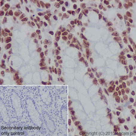 Immunohistochemistry (Formalin/PFA-fixed paraffin-embedded sections) - Anti-Histone H3 (formyl K122) antibody [EPR17896] - BSA and Azide free (AB249958)