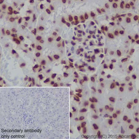 Immunohistochemistry (Formalin/PFA-fixed paraffin-embedded sections) - Anti-Histone H3 (formyl K122) antibody [EPR17896] - BSA and Azide free (AB249958)