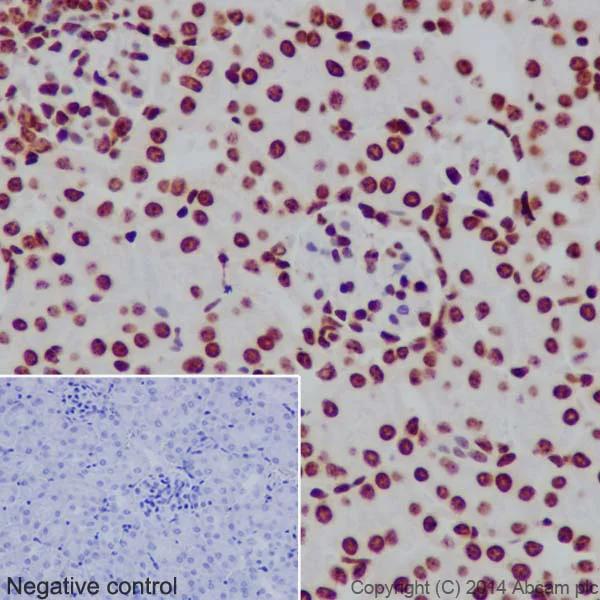 Immunohistochemistry (Formalin/PFA-fixed paraffin-embedded sections) - Anti-Histone H3 (mono methyl K18) antibody [EPR17710] (AB177253)