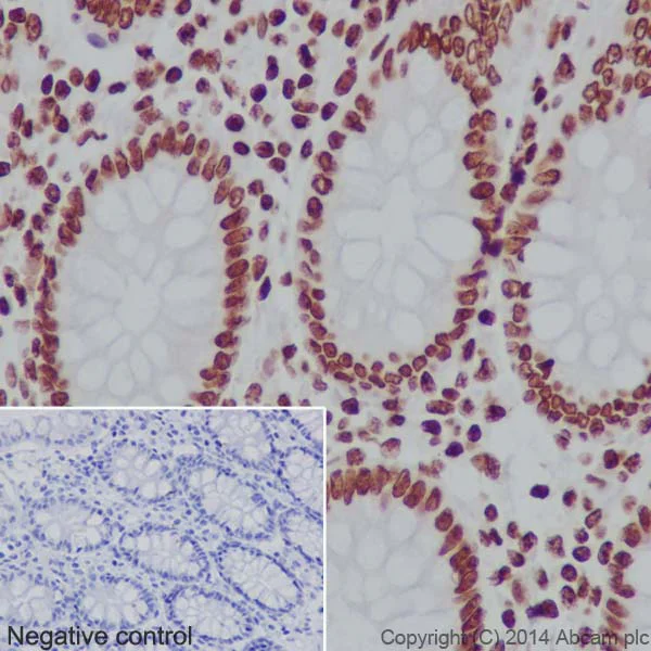 Immunohistochemistry (Formalin/PFA-fixed paraffin-embedded sections) - Anti-Histone H3 (mono methyl K18) antibody [EPR17710] - BSA and Azide free (AB249952)