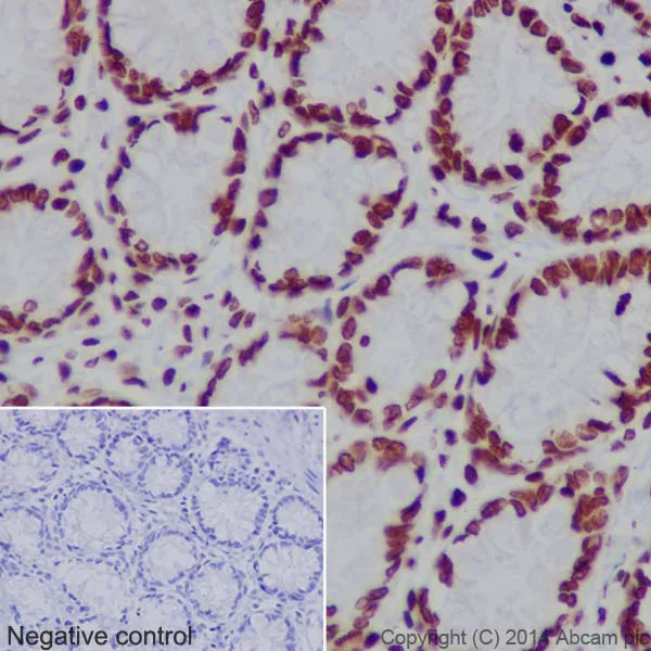 Immunohistochemistry (Formalin/PFA-fixed paraffin-embedded sections) - Anti-Histone H3 (mono methyl K18) antibody [EPR17710] - BSA and Azide free (AB249952)