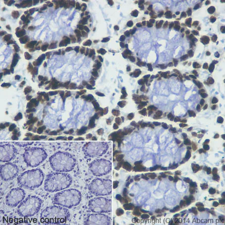 Immunohistochemistry (Formalin/PFA-fixed paraffin-embedded sections) - Anti-Histone H3 (mono methyl K4) antibody [ERP16597] - ChIP Grade (AB176877)