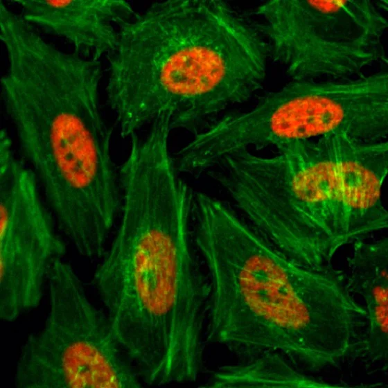 Immunocytochemistry/ Immunofluorescence - Anti-Histone H3 (mono methyl K4) antibody [RM140] (AB205256)