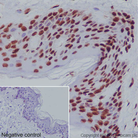 Immunohistochemistry (Formalin/PFA-fixed paraffin-embedded sections) - Anti-Histone H3 (mono methyl K79) antibody [EPR17466] - BSA and Azide free (AB249946)
