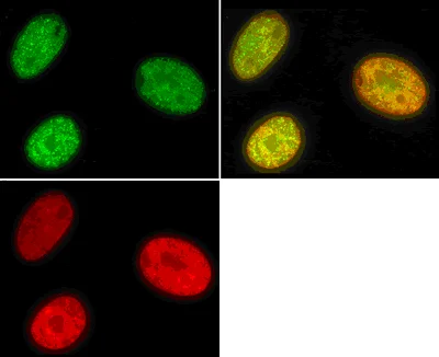 Immunocytochemistry/ Immunofluorescence - Anti-Histone H3 (mono methyl K9) antibody - ChIP Grade (AB9045)