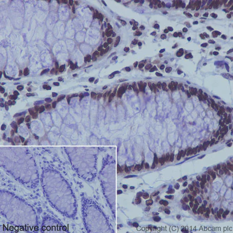 Immunohistochemistry (Formalin/PFA-fixed paraffin-embedded sections) - Anti-Histone H3 (mono methyl K9) antibody [EPR16989] - BSA and Azide free (AB203955)