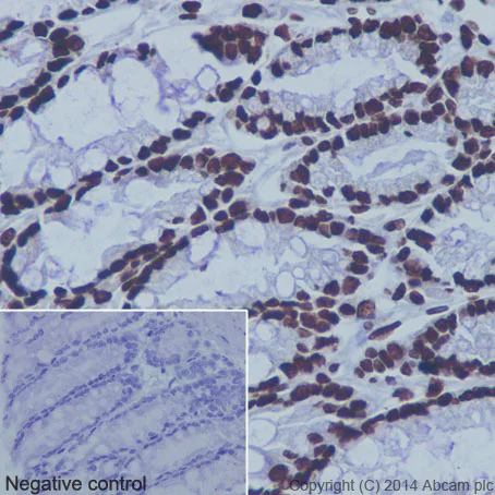 Immunohistochemistry (Formalin/PFA-fixed paraffin-embedded sections) - Anti-Histone H3 (mono methyl K9) antibody [EPR16989] - BSA and Azide free (AB203955)