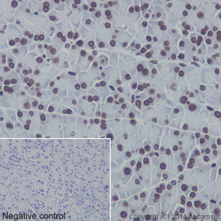 Immunohistochemistry (Formalin/PFA-fixed paraffin-embedded sections) - Anti-Histone H3 (mono methyl R17) antibody [EPR17247] - BSA and Azide free (ab249950), expandable thumbnail