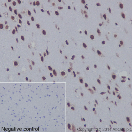 Immunohistochemistry (Formalin/PFA-fixed paraffin-embedded sections) - Anti-Histone H3 (mono methyl R17) antibody [EPR17247] - BSA and Azide free (AB249950), expandable thumbnail
