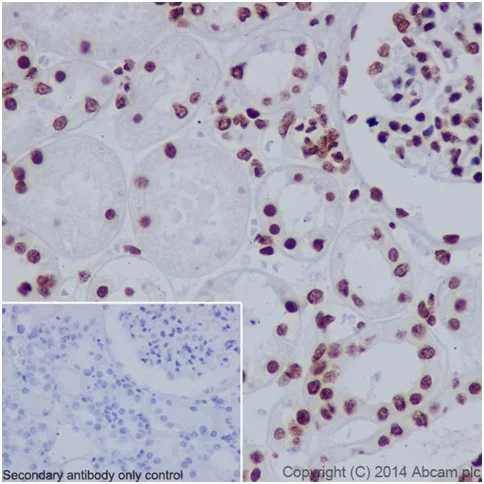 Immunohistochemistry (Formalin/PFA-fixed paraffin-embedded sections) - Anti-Histone H3 (mono methyl R63, di methyl R63) antibody [EPR17722] (AB196724)