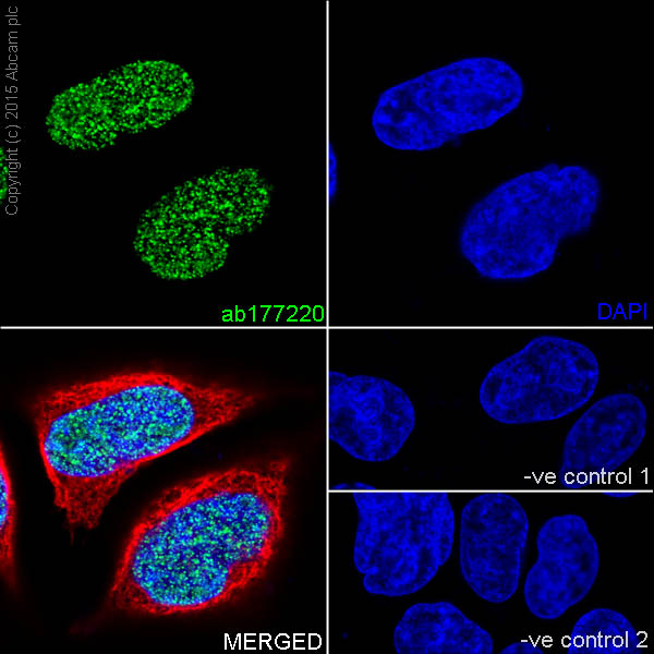 Immunocytochemistry/ Immunofluorescence - Anti-Histone H3 (mono+di+tri methyl K14) antibody [EPR17708-253] (AB177220)