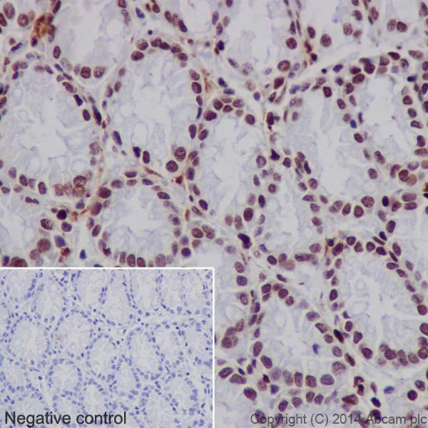 Immunohistochemistry (Formalin/PFA-fixed paraffin-embedded sections) - Anti-Histone H3 (mono+di+tri methyl K79) antibody [EPR17468] - BSA and Azide free (AB240197)