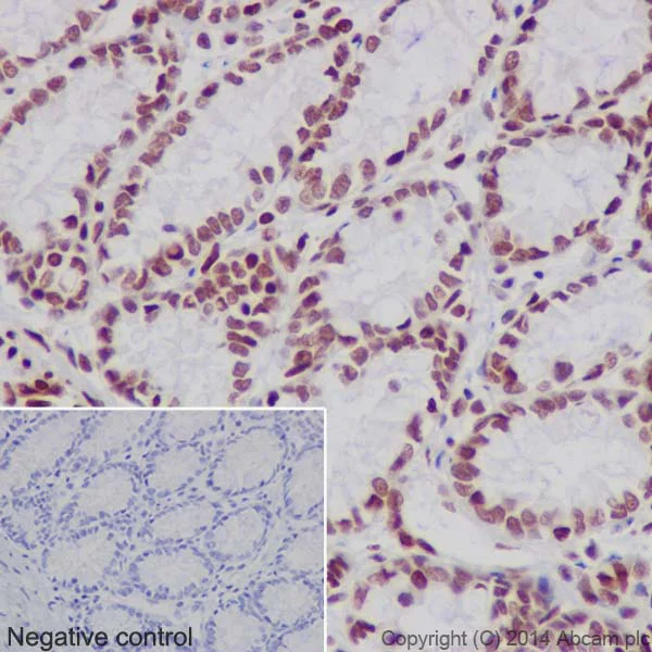 Immunohistochemistry (Formalin/PFA-fixed paraffin-embedded sections) - Anti-Histone H3 (mono+di+tri methyl K79) antibody [EPR17468] - BSA and Azide free (AB240197)
