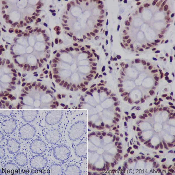 Immunohistochemistry (Formalin/PFA-fixed paraffin-embedded sections) - Anti-Histone H3 (mono+di+tri methyl K79) antibody [EPR17468] - BSA and Azide free (AB240197)