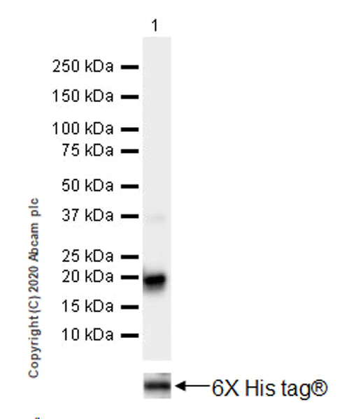Western blot - Anti-Histone H3 (mutated K27M) antibody [EPR18340] - ChIP Grade (AB190631)