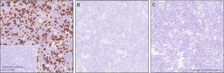 Immunohistochemistry (Formalin/PFA-fixed paraffin-embedded sections) - Anti-Histone H3 (mutated K27M) antibody [EPR18340] - ChIP Grade - BSA and Azide free (AB240310)